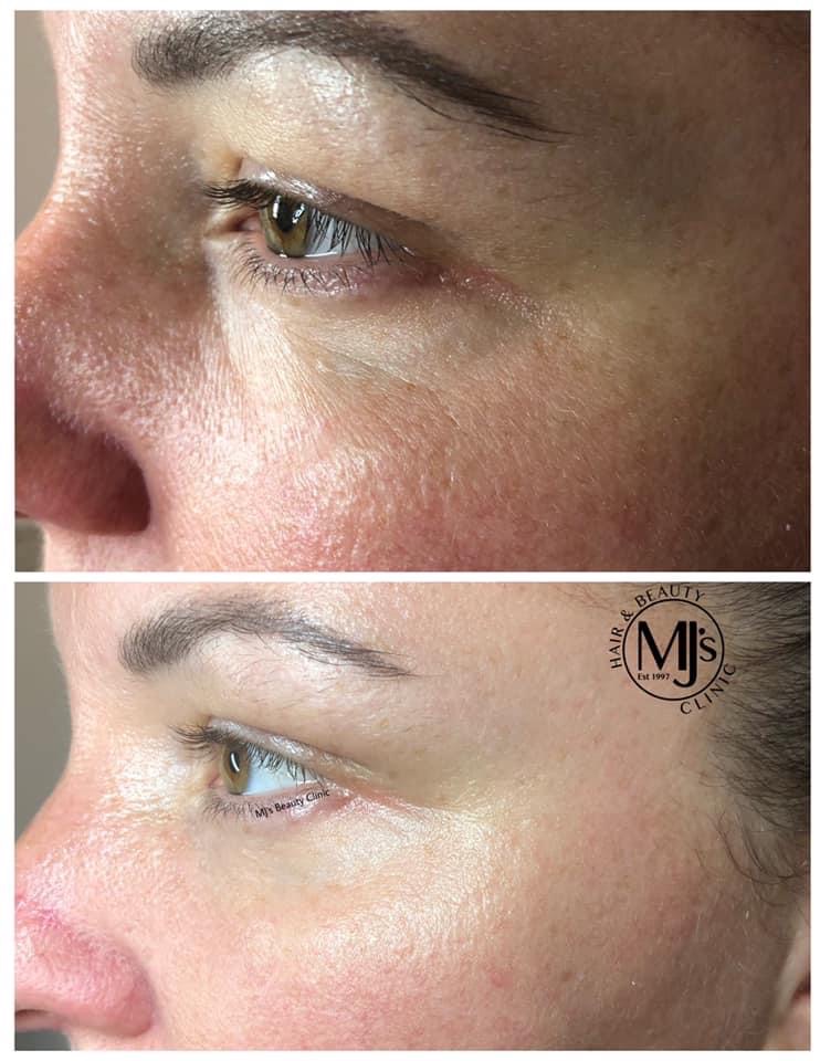 i-Tx Biomimetic Peptide Eye Cream 