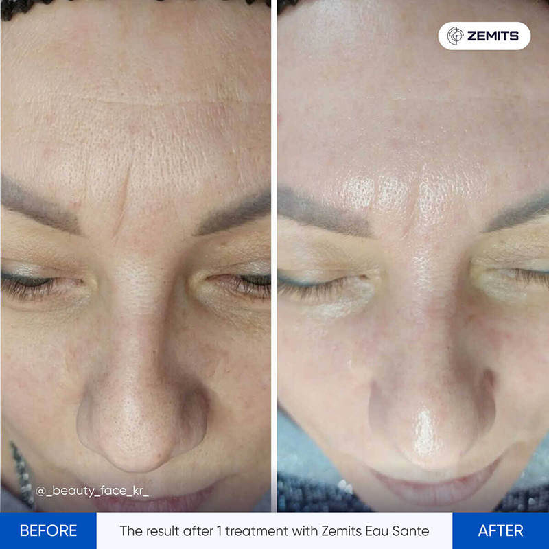 Zemits Eau Sante